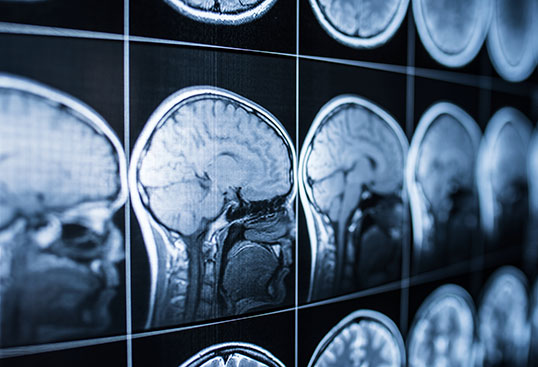 Brain imaging